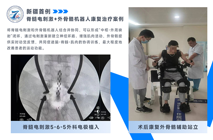 新疆醫(yī)科大學第七附屬醫(yī)院分享首例脊髓電刺激+外骨骼治療！